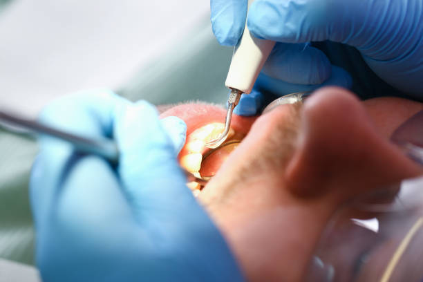 Best Walk-In Emergency Dentist in Lindsay, TX
