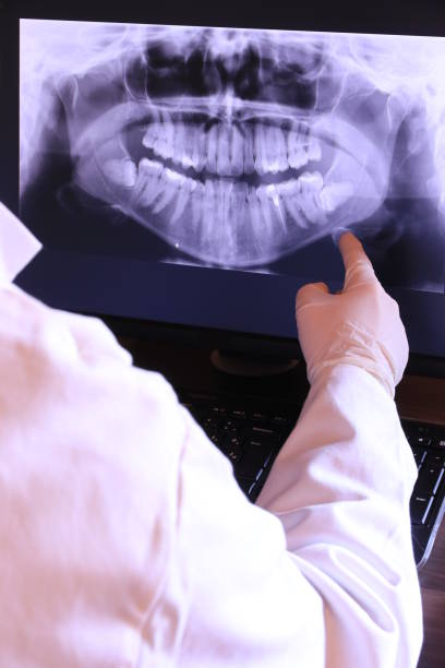 Best Emergency Broken Tooth Repair in Lindsay, TX